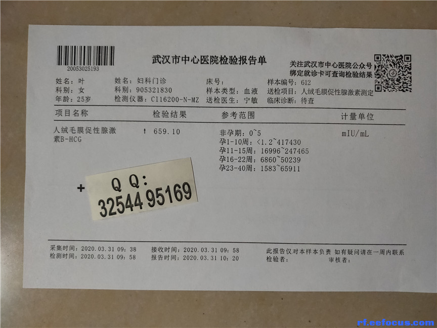 武汉市 贵溪市怀孕一个月b超单 彩色怀孕b超单 检查报告图片